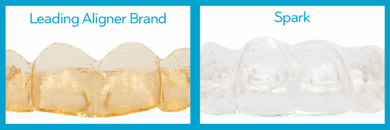Spark™ Clear Aligner System is proven to have minimal aligner stains compared to the leading aligner brand.