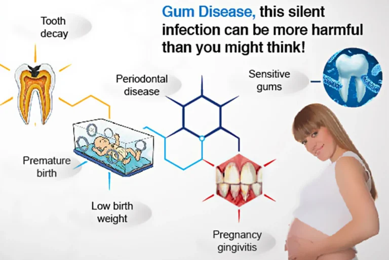 Ensuring Healthy Smiles During Pregnancy – A Focus on Gum Health