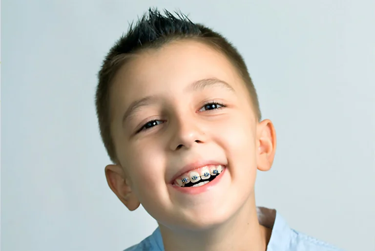 The Power of Early Intervention – Orthodontics in Paediatric Dentistry